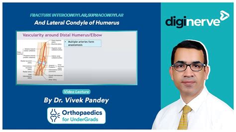 Fracture Intercondylar Supracondylar And Lateral Condyle Of Humerus Dr Vivek Pandey Youtube