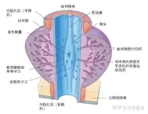 前列腺炎为何难以治愈？ 知乎