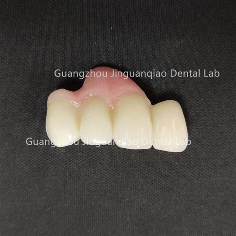 China Dental Lab Customize Dental Products Pfm Ceramic Zirconia Bridge