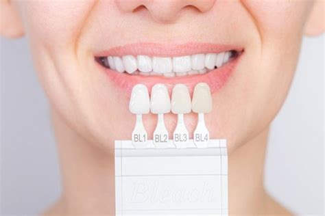 Porcelain Veneers Cabramatta Dental Care