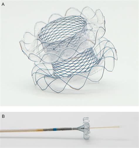 Design Considerations Of The Novel Lumen Apposing Metal Stents Niti S