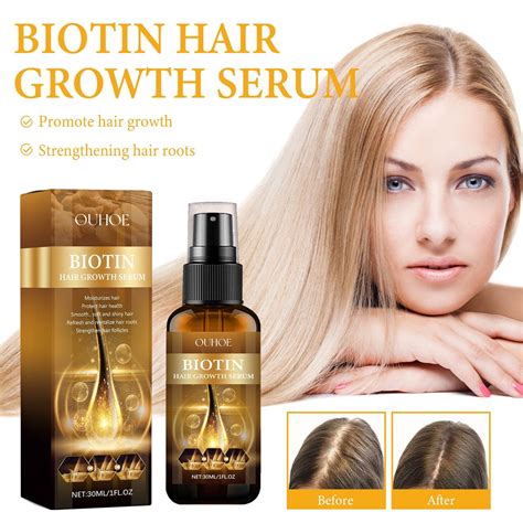 New Upgrated Luxury Biotin Hair Growth Serum Biotin Hair Growth Spray Biotin Hair Growth Serum