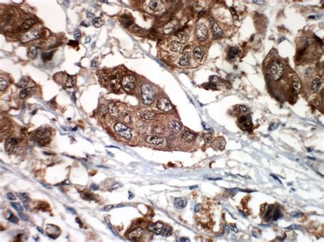 cdk ep pathnsitu biotechnologies