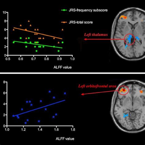 Correlations Between ALFF Value Of Significantly Different Areas And