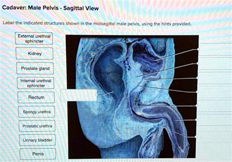 Cadaver Male Pelvis Sagittal View Label The Indicated Structures