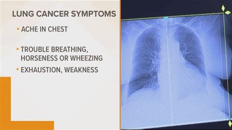 What Are The Symptoms If You Have Lung Cancer : Lung Cancer Macmillan ...