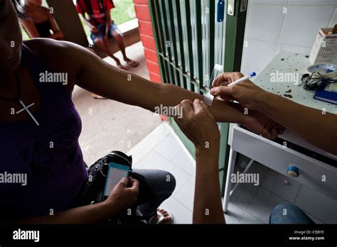 Tuberculosis Test Mantoux Hi Res Stock Photography And Images Alamy