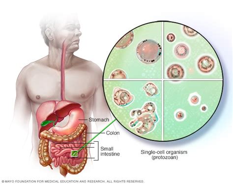 Blastocystis Hominis Causas Síntomas Y Tratamiento Medicina Básica