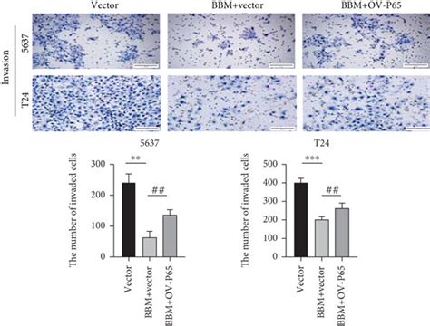 Berbamine inhibited the NF κB pathway in bladder cancer cell lines a