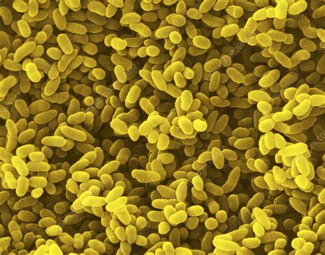 False Col Sem Of Klebsiella Pneumoniae Stock Image B