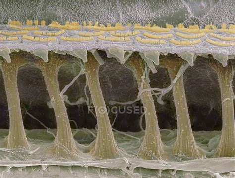 Coloured Scanning Electron Micrograph SEM Of Sensory Hair Cells In