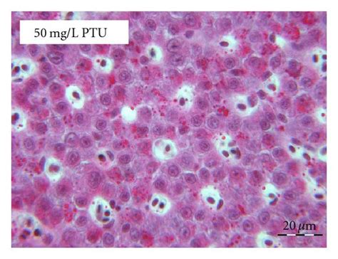 Representative Histopathological Alterations In Hepatocytes Of Control Download Scientific