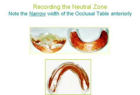 Dentistry And Medicine Concept Of Neutral Zone