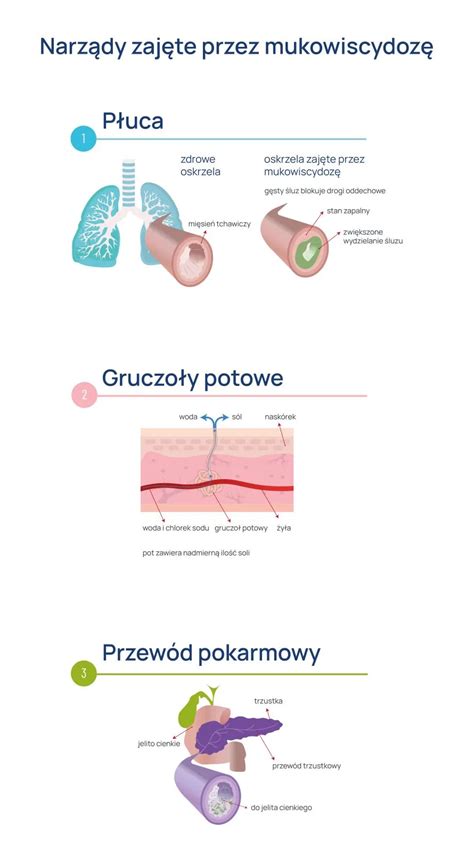 Mukowiscydoza Co To Za Choroba Objawy Przyczyny Leczenie