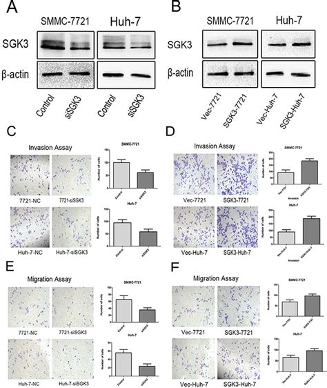 Mir 155 Promotes Epithelial Mesenchymal Transition In Hepatocellular