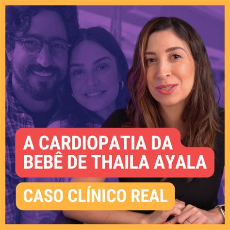 Apostila Caso Clínico Real Comunicação Interventricular Material de