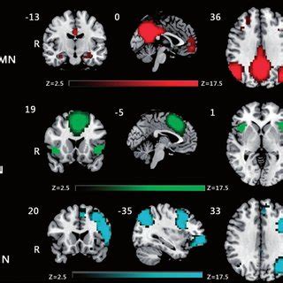 Spatial Maps Of The Resting State ICN Of Interest Identified By