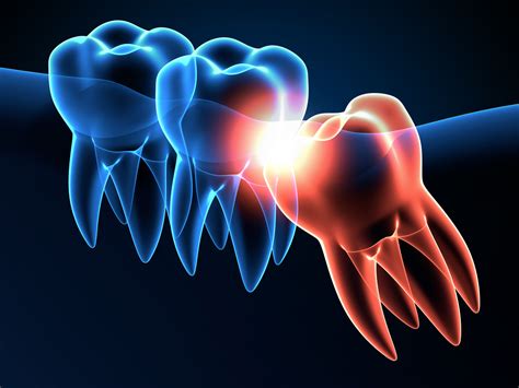 Wisdom Teeth Function Boston Dentist Congress Dental Group