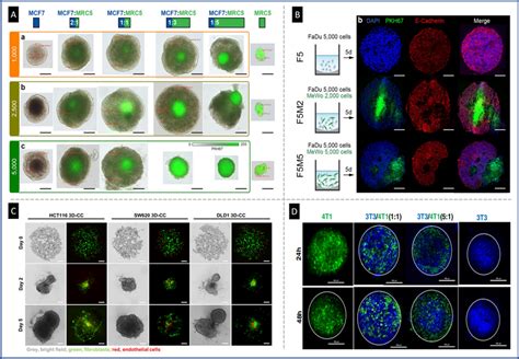 Fibroblasts Distribution In Heterotypic Spheroid Tumor Models A