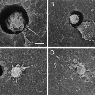 Scanning Electron Photomicrographs Of The Lower Side Of The Matrigel