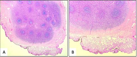 A B Hematoxylin And Eosin Stain A 10x B 20x Low And