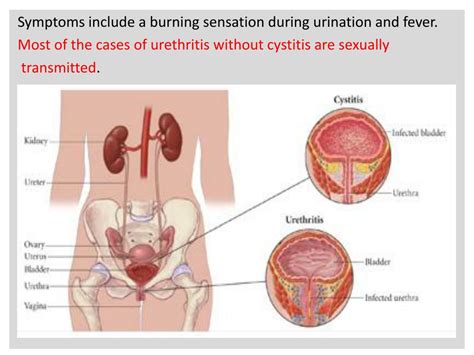 Ppt Lower Urinary Tract Infection Powerpoint Presentation Free