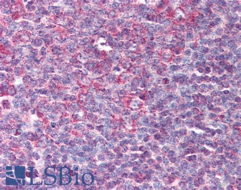 Ihc Plus Defb Beta Defensin Polyclonal Antibody Rabbit Ihc Lsbio