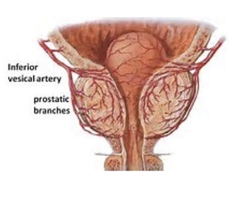 Prostate Notes Flashcards Quizlet