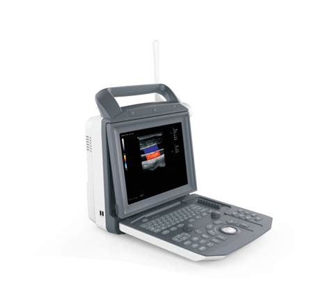 Portable Color Doppler Ultrasound Diagnostic System Ultrasound System