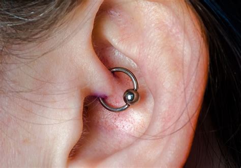 Ear Piercings For Migraines Amherst Wellness Center