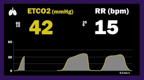 3 Capnography Waveform Videos