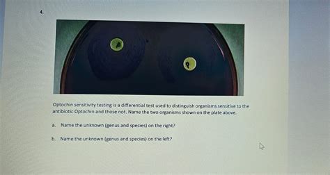 Solved Optochin Sensitivity Testing Is A Differential Test Chegg