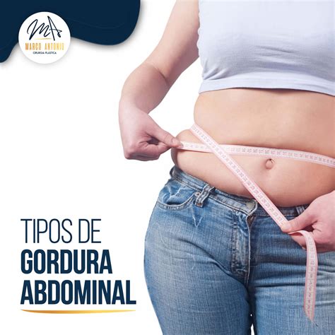 Tipos De Gordura Abdominal Marco Antonio Rocha