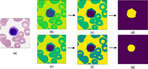 Figure 2 From Detection And Classification Of Immature Leukocytes For