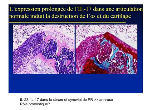 Cytokines inflammatoires ppt télécharger