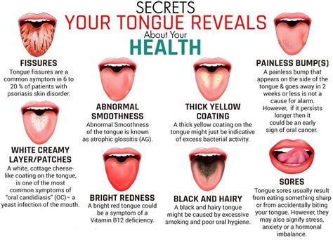 What-Your-Tongue-Says-About-Your-Health | Tongue health, Health tips, Health remedies