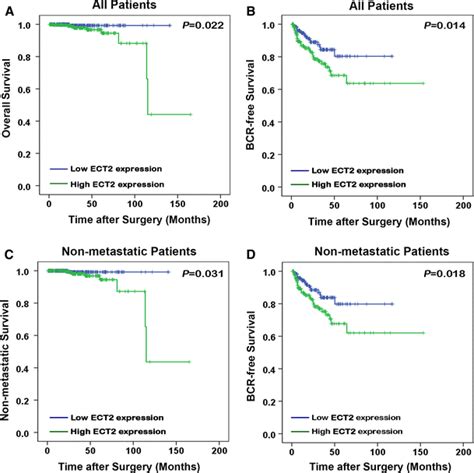 High Levels Of Ect2 Predict A Poor Prognosis Of PCa Patients A B