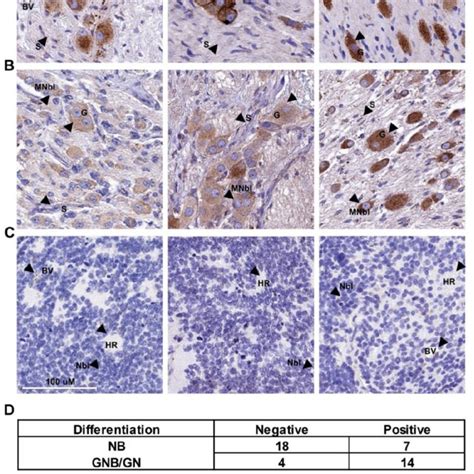 Bmp And Wnt Regulate Notch Signaling In Neuroblastoma A Regulation