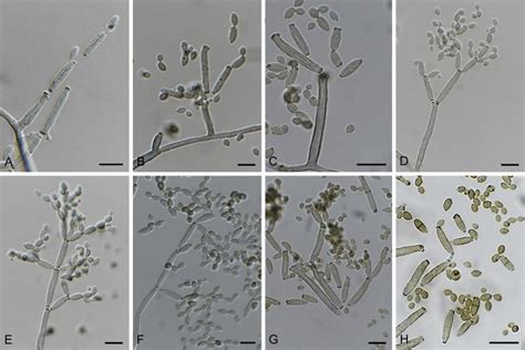 Cladosporium Austrohemisphaericum Cbs 140482 Af Micro Semimacro