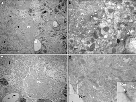 Electron Microscopy Analysis Transmission Electron Micrographs Of