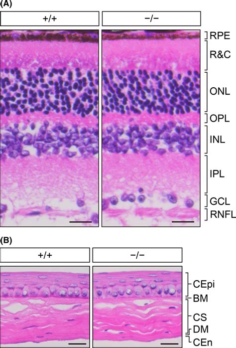 Normal Retinal And Corneal Histology In Elovl1−− Tgivl‐elovl1 Mice