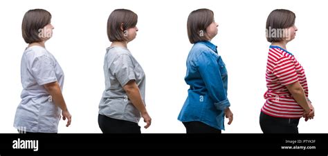 collage   sydrome woman  isolated background   side