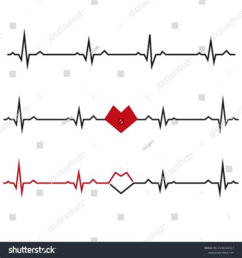 Electro Cardio: Over 122 Royalty-Free Licensable Stock Vectors & Vector