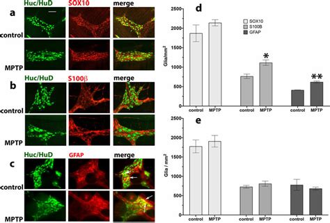 Effect Of Mptp Treatment On Sox S And Gfap Ir Glial Cells In