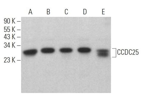 Ccdc25抗体 F 7 Scbt Santa Cruz Biotechnology