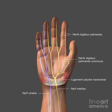 Carpal Tunnel Syndrome Photograph By Fernando Da Cunhascience Photo