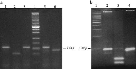 DNA methylation assay of IS 1 (a) and IS 2 (b) amplicons. Portions (10... | Download Scientific ...