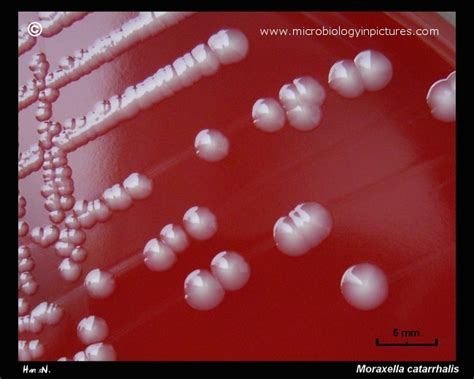 Moraxella catarrhalis colonies on blood agar. Colony morphology of M ...