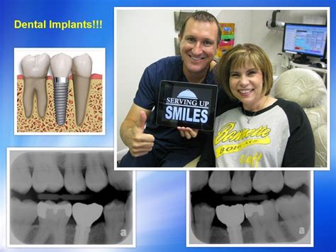 Got Dental Implants Dr Michael Nugent Is A Leader In Dental Implant