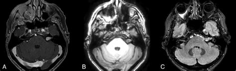 Axial Sections From Preoperative Magnetic Resonance Imaging With